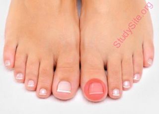 toenail (Oops! image not found)